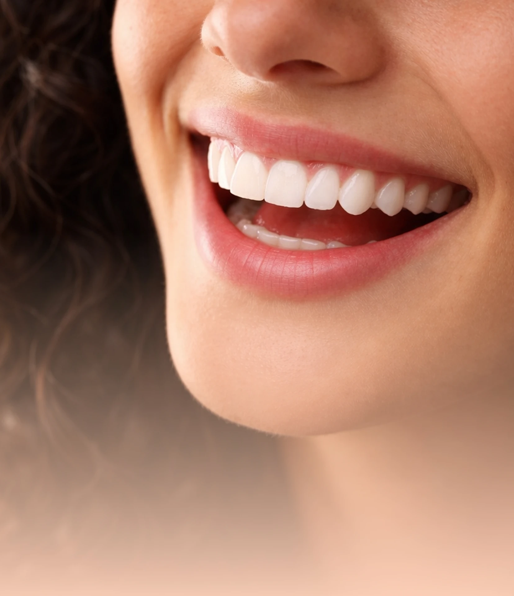 Dental Veneers