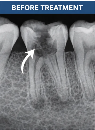 After image