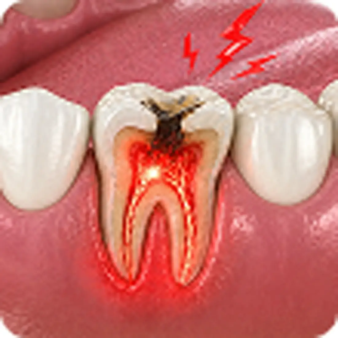 Dental Emergency